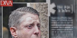 Lapo Elkann letteralmente a pezzi: paparazzato dopo la grande truffa gossip news Lapo Elkann letteralmente a pezzi: paparazzato dopo la grande truffa
